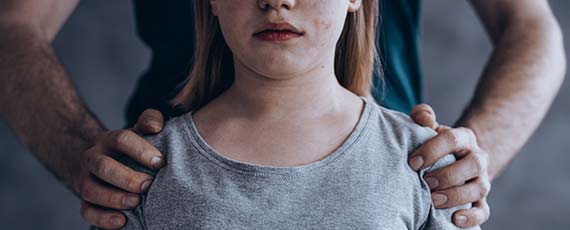 Begutachtung bei (Verdacht auf) Kindeswohlgefährdung